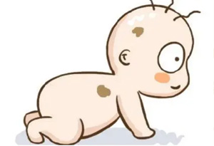 宝宝胎记分好坏，这种胎记需警惕！